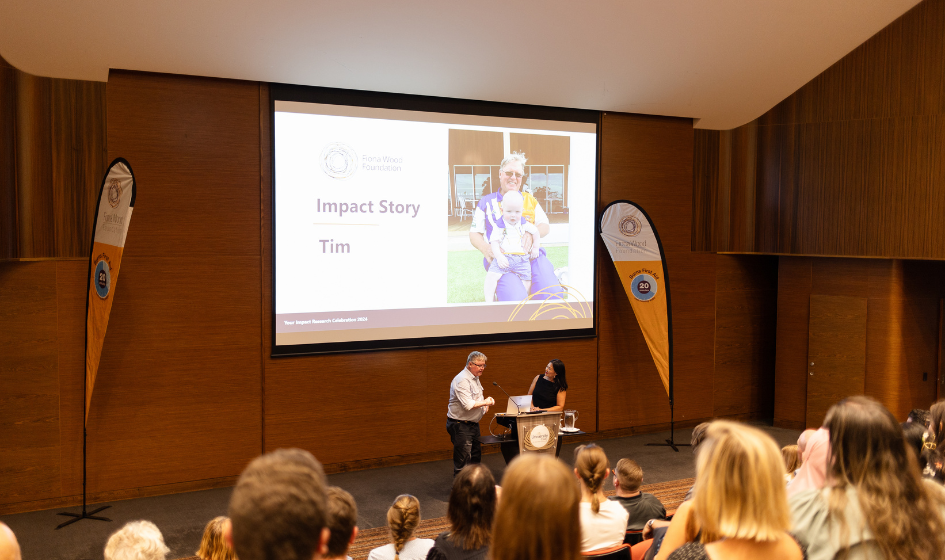 Image for Examples of deep partial thickness burns.