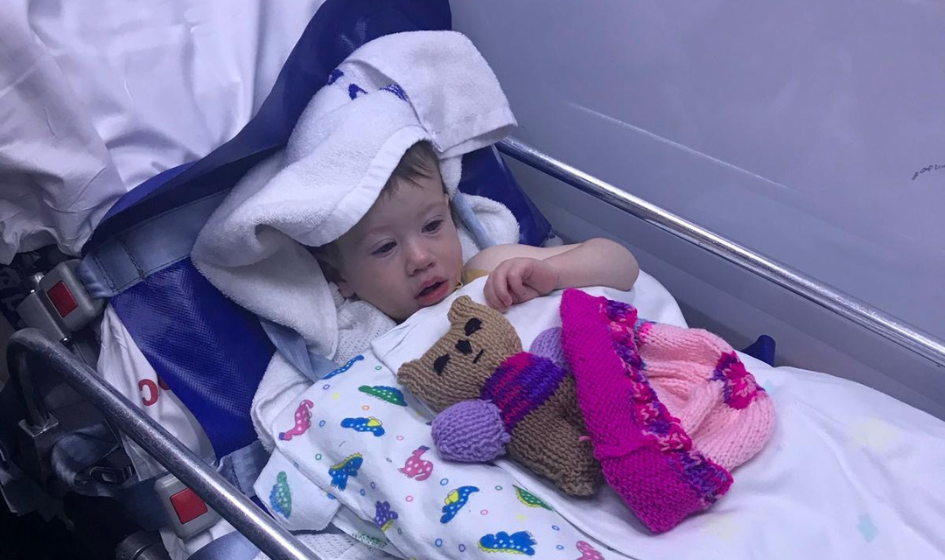 Image for Examples of deep partial thickness burns.